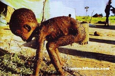 这个<em>身上</em>爬满蚊虫、苍蝇的非洲小男孩的<em>照片</em>,